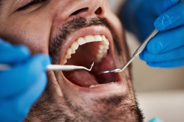Best Emergency Gum Treatment in East Wenatchee, WA